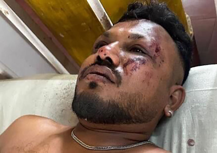 “Coincidence?”: Thai Actor Who Survived Plane Crash Discovers Eerie Link To Air India’s Only Survivor - Shocking 2025 11 6 684bf202c17ba 700 684dc60959e57 700