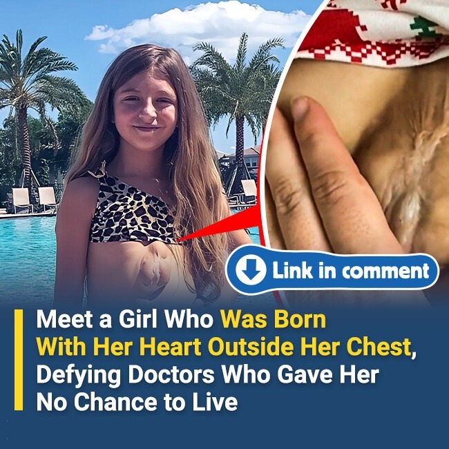 Meet the Girl Born with Her Heart Outside Her Chest — Defying Doctors Who Gave Her No Chance - 2025 8 Meet the Girl Born with Her Heart Outside Her Chest