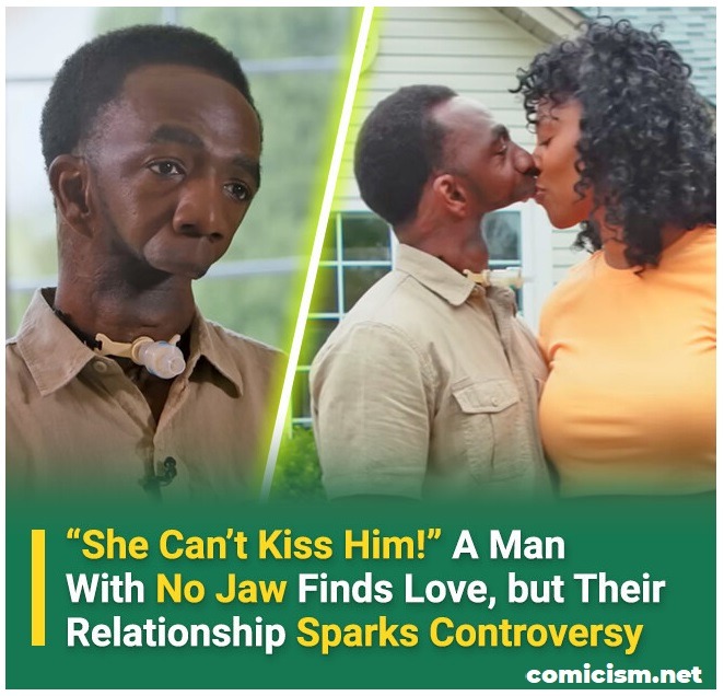 A Man Born Without a Jaw, Yet She Fell in Love—Now Their Relationship Sparks Heated Controversy: “She Can’t Kiss Him! Strange - 2025 2 A Man Born Without a Jaw, Yet She Fell in Love—Now Their Relationship Sparks Heated Controversy: “She Can’t Kiss Him! Strange - 2025