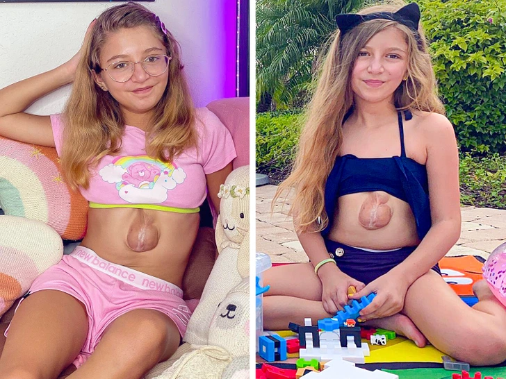 Meet the Girl Born with Her Heart Outside Her Chest — Defying Doctors Who Gave Her No Chance - 2025 6 Meet the Girl Born with Her Heart Outside Her Chest