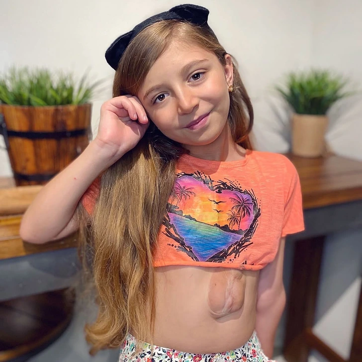 Meet the Girl Born with Her Heart Outside Her Chest — Defying Doctors Who Gave Her No Chance - 2025 7 Meet the Girl Born with Her Heart Outside Her Chest
