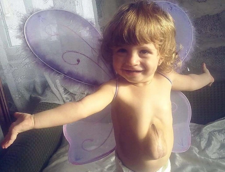 Meet the Girl Born with Her Heart Outside Her Chest — Defying Doctors Who Gave Her No Chance - 2025 2 Meet the Girl Born with Her Heart Outside Her Chest