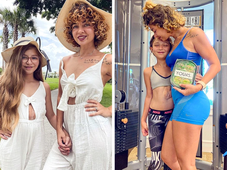 Meet the Girl Born with Her Heart Outside Her Chest — Defying Doctors Who Gave Her No Chance - 2025 4 Meet the Girl Born with Her Heart Outside Her Chest